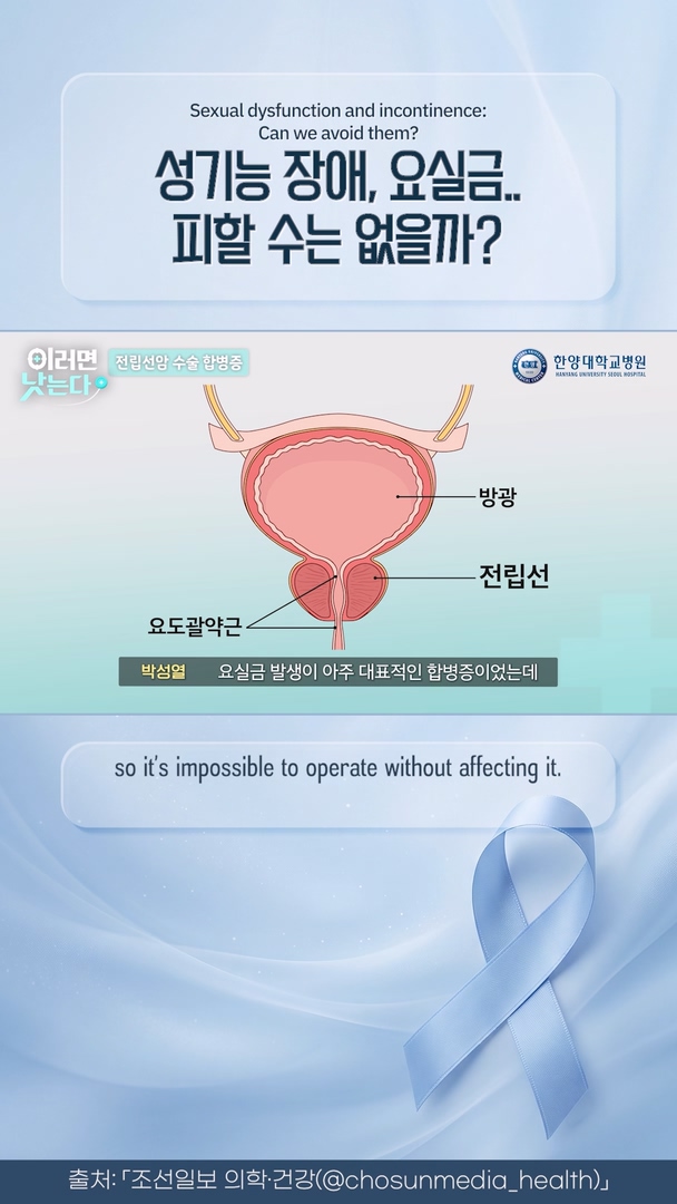전립선 수술 부작용 피할 순 없을까? 현명한 암 치료는
