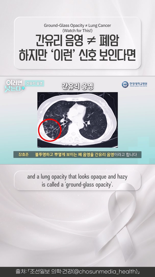 건강검진에서 '간유리 음영' 들었다면 꼭 보세요          