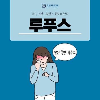 감기, 근육통, 관절통이 전신 홍반 루푸스일 수도 있다?