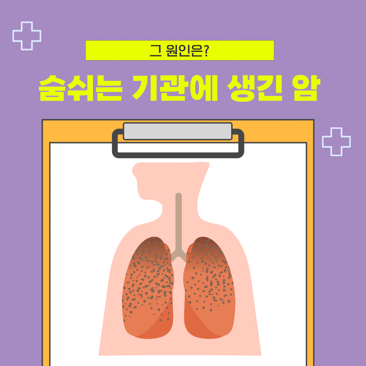 숨쉬는 기관에 생긴 암, 그 원인은?