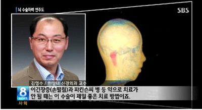 뇌수술 받는 도중에 환자가 기타 연주를...뇌심부 자극술