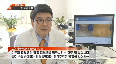 재생 화장지 너무 하얗다면…아토피 조심