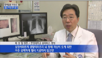 천의 얼굴을 가진 병 루푸스 20·30대 여성 위협