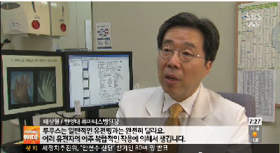 젊은 여성의 병 루푸스…조기 발견이 중요