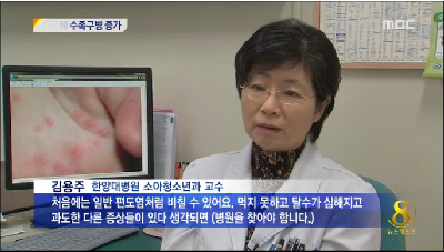 때이른 더위에 수족구병 조기유행 조짐...영유아 위생 주의
