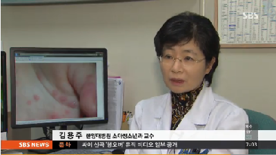 때이른 더위에 수족구병 급증...예방법은?