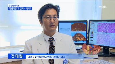 A형 간염