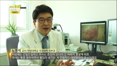 [생생정보]내몸이 보내는 적신호_대상포진