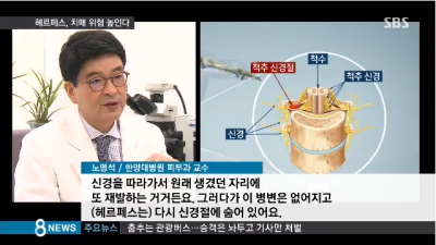 [8시뉴스]몸속에 숨어있는 헤르페스, 치매 위험 높인다