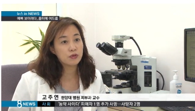 [8시뉴스]빨간 입술 화장하는 여학생들…피부 적신호