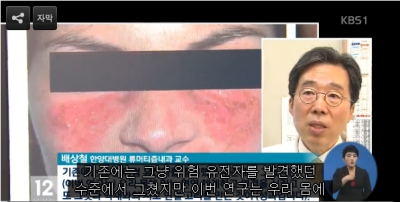 [뉴스12] 천의 얼굴 루푸스 유전자 다수 확인