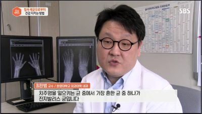 [모닝와이드]입속 세균으로부터 잇몸 건강 지키는 방법!