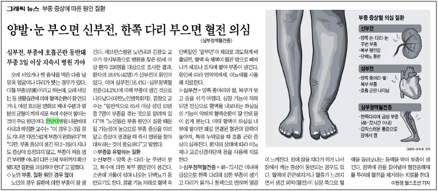 양발·눈 부으면 신부전, 한쪽 다리 부으면 혈전 의심