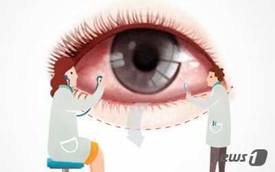 젊어지려 '하안검' 수술…눈꺼풀 뒤집혀 고민하는 중년들