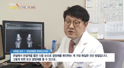 [쿠키건강뉴스-체크리포트] “다시 아플까봐 두려워요” ‘요산 침착’ 통풍, 식생활 서구화로 발병 범주 확대…습관 개선으로 지속 관리