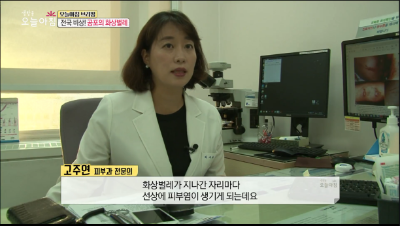 [오늘아침]전국 비상! 공포의 화상벌레