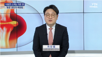 [YTN사이언스]내 몸 보고서_통풍