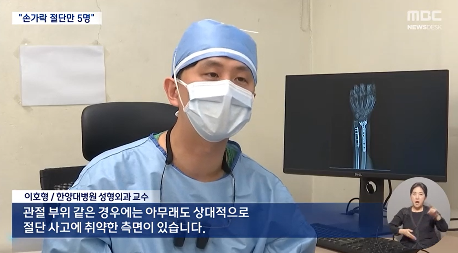 "손가락 절단만 5명"‥공포의 고깃집 깡통의자 주의