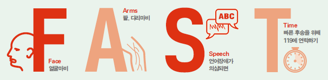 Face 얼굴마비, Arms 팔 ·다리마비, Speech 언어장애가 의심되면, Time 빠른 후송을 위해 119에 연락하기