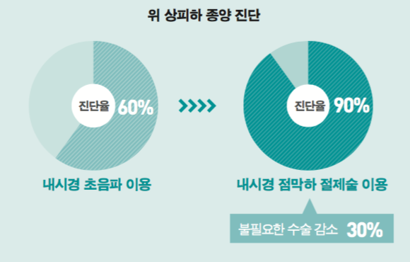 위 상피하 종양 진단